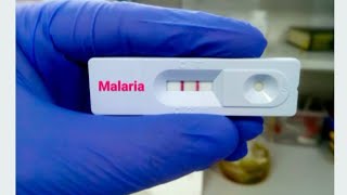 How To Use Malaria Rapid Diagnostic Test  Step by Step [upl. by Ecinehs28]