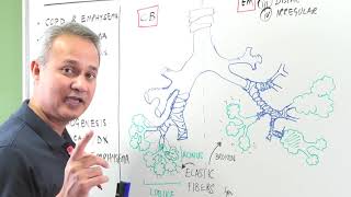 Comparison of Emphysema with Chronic Bronchitis [upl. by Venetia982]