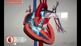 Repairing the Heart Unifocalization  Stanford Childrens Health [upl. by Berneta]