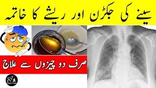 Chest Flu  Seeny Ki Jakran Or balgam Ka Ilaj  Seeny Main Jama Resha Fori Bahir [upl. by Darnok445]