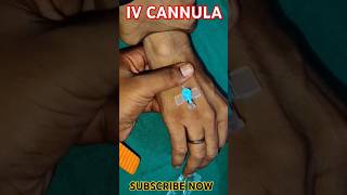 IV CANNULA INSERTION 🩺💉🩺💉🩺💉💉💉💉💉🩺💉cannula youtubeshorts shortshospital viral medicarenurshing [upl. by Belamy]