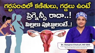 Understanding Uterine Fibroids And Causes  DrSwapna Chekuri  Hyderabad Fertility Center [upl. by Lounge]