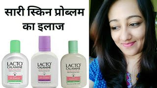 LACTO CALAMINE LOTION REVIEW IN HINDI FOR OILY amp DRY SKIN HOW TO APPLYUSE BENEFITS [upl. by Izabel]