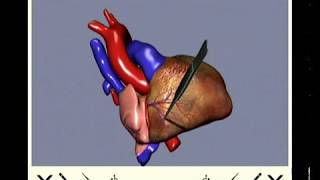 Virtual Open Heart Surgery [upl. by Aihsekin]