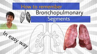 How to remember bronchopulmonary segments Anatomy [upl. by Gerald]