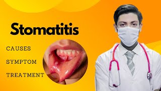 quotStomatitis Symptoms Causes and Treatment  Comprehensive Guide for Oral Healthquot [upl. by Cormack]