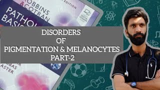 DISORDERS OF PIGMENTATION AND MELANOCYTES PART2 PATHOLOGY ROBBINS BASIS [upl. by Mendie]