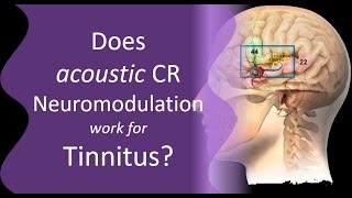 Is CR Neuromodulation Effective for Tinnitus [upl. by Onitrof]