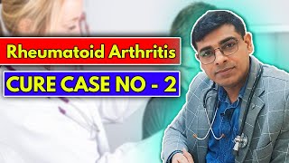 Rheumatoid Arthritis Case No  2  A Cure Case of Rheumatoid Arthritis  Dr Abhik Ghosh Homeopathy [upl. by Greabe]