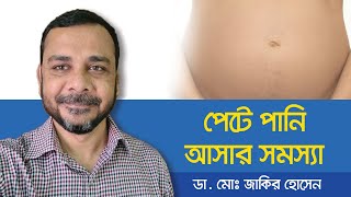 Ascites Treatment  How is ascites treated  পেটে পানি আসলে করণীয়  পেটে পানি জমার লক্ষণ [upl. by Ennaeed]