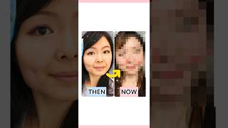 1MIN🍎FULLER CHEEKS EXERCISE🍎GET CHUBBY CHEEKS CHEEK LIFT NATURALLY✨ANTIAGING FACE EXERCISE✨ [upl. by Mongeau]