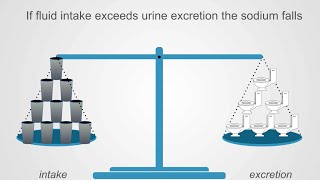 Hyponatremia Basics Understanding Water Intake amp Urine Output [upl. by Katusha]