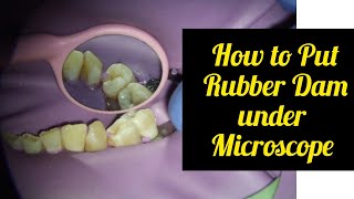 How to Put Rubber Dam for Lower Front Teeth  Multiple Anterior Teeth Isolation [upl. by Cerys]