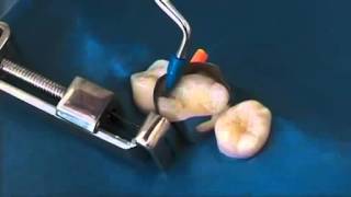 Ivoclar Vivadent AccessoryOptraMatrix OptraSculpt OptraContack [upl. by Jenifer]