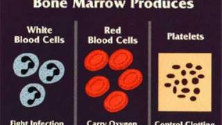 Aplastic Anemia [upl. by Lig]