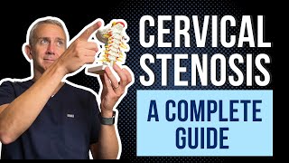 Cervical Spine Stenosis  A Complete Guide [upl. by Htnamas]