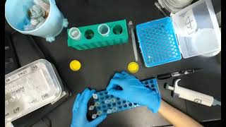 Plasmid Extraction from Ecoli Bacteria [upl. by Ellord137]