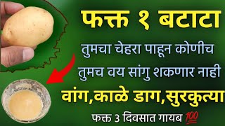 फक्त १ बटाटा चेहऱ्यावरील वांग काळे डाग सुरकुत्या १०० गायब होणार एकदा नक्की [upl. by Nwahc]