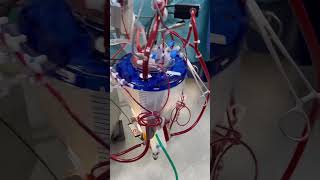 Cardiac perfusionist shorts perfusion heart hospital mbbs ott doctor shorts trending live [upl. by Tait228]