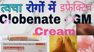 Clobenate  GM Cream Uses in hindi  क्लोबिनेट  जीएम क्रीम के फायदे [upl. by Hsotnas34]