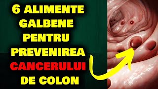 6 ALIMENTE GALBENE PENTRU A PREVENI CANCERUL DE COLON ȘI POLIPII [upl. by Ytima960]