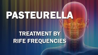 Pasteurella  RIFE Frequencies Treatment  Energy amp Quantum Medicine with Bioresonance [upl. by Airakaz]