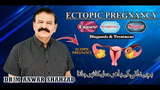 Ectopic Pregnancy  its Causes Signs Symptoms Diagnosis amp Treatment [upl. by Henriha]