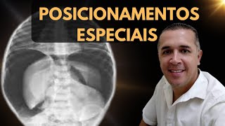 A Técnica Ideal Para Detectar o Pneumoperitônio no Raio X [upl. by Giark]