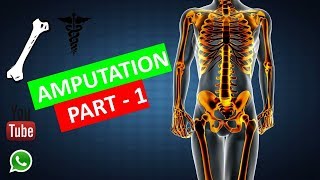 Orthopedics  AMPUTATION FMGENEETPG [upl. by Tenner3]