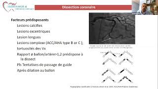 CSCWebinar 017 Gestion des complications du cathétérisme cardiaque interventionnel [upl. by Aryc]