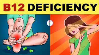 Vitamin B12 Deficiency Symptoms  B12 Deficiency  Vitamin B12  All You Need to Know [upl. by Hatti]