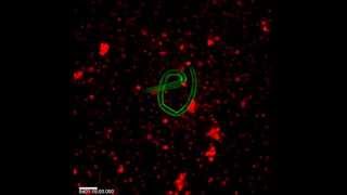 Eosinophils Detect a Worm and Swarm [upl. by Ternan]