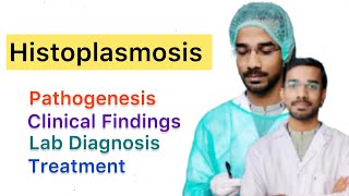 Histoplasmosis  Pathogenesis  Clinical Diagnosis  Treatment [upl. by Uhile]