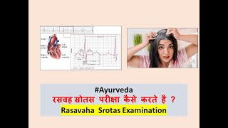 Ayurveda Clinical Examination l Rasavaha Srotas Examination l Trividha Pariksha l ayurveda [upl. by Ushijima290]