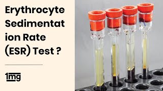 What is Erythrocyte Sedimentation Rate ESR Test  1mg [upl. by Lubeck71]