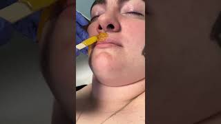 Professional upper lip wax using vegan wax formula from Starpil waxing hairremoval esthetician [upl. by Varrian539]