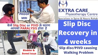 Slipped Disc 85 Recovery in 28 Days  Complete Walking after PIVD  With Proof MRI [upl. by Avert726]