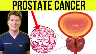 What is PROSTATE CANCER Doctor explains SIGNS SYMPTOMS TREATMENT and more [upl. by Morly]