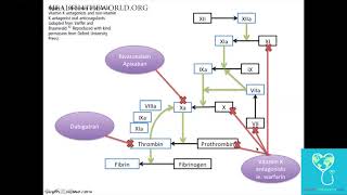 Intracerebral Hemorrhage Part 4  Health4TheWorld Academy [upl. by Llednahs]