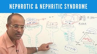 Nephrotic and Nephritic Syndrome  Causes Symptoms amp Treatment🩺 [upl. by Farny]