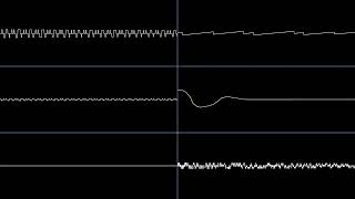 MF DOOM  quotCoffin Nailsquot JRB Cover V2 Oscilloscope View [upl. by Uriisa]