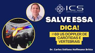 Ultrassom Vascular com Doppler de carótidas e vertebrais [upl. by Eeliah]