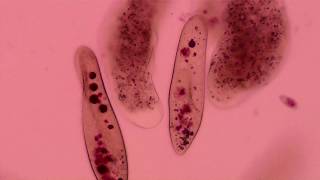 Amoeba extends pseudopods to capture its prey [upl. by Little410]