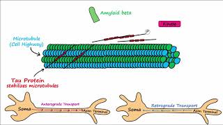 Alzheimers Disease  plaques tangles pathogenesis risk factors disease progression [upl. by Olyhs]