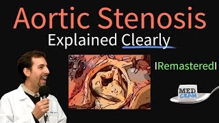 Aortic Stenosis Remastered Symptoms murmur aortic valve stenosis treatment [upl. by Etnwahs]