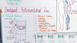 Proposed intervertebral disc pivd part2 [upl. by Oralle609]