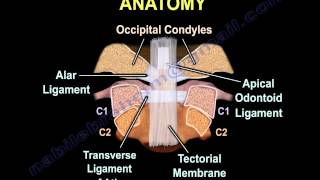 Occipital Condyle Fractures  Everything You Need To Know  Dr Nabil Ebraheim [upl. by Jessalin]