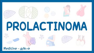 Prolactinoma  definition causes pathophysiology clinical picture investigations amp treatment شرح [upl. by Sido]