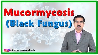 Mucormycosis  Black fungus disease in Covid 19 Causes Signs amp Symptoms Diagnosis and Treatment [upl. by Gaeta]