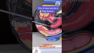 How to do pap smear  pap smear procedure  gynecology pap smear  medical learner  steps to do pap [upl. by Storm888]